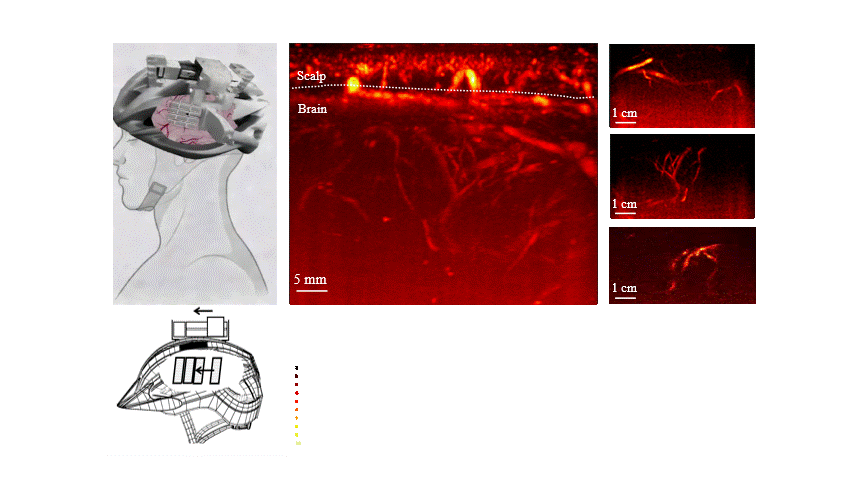Neural Interface System